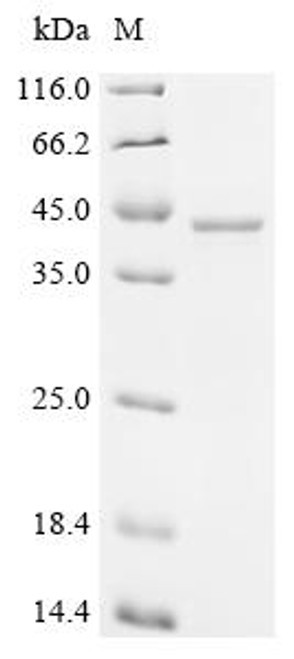 Recombinant Human Serine/threonine-protein phosphatase 2A catalytic subunit alpha isoform (PPP2CA) (CSB-EP018559HUc7) Recombinant Human Serine/threonine-protein phosphatase 2A catalytic subunit alpha isoform (PPP2CA) (CSB-EP018559HUc7)