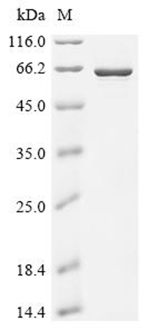 Recombinant Human Bifunctional arginine demethylase and lysyl-hydroxylase JMJD6 (JMJD6) (CSB-EP750768HU) Recombinant Human Bifunctional arginine demethylase and lysyl-hydroxylase JMJD6 (JMJD6) (CSB-EP750768HU)