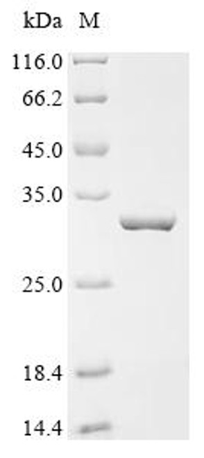 Recombinant Newcastle disease virus RNA-directed RNA polymerase L (L), partial (CSB-EP887622NCT) Recombinant Newcastle disease virus RNA-directed RNA polymerase L (L), partial (CSB-EP887622NCT)
