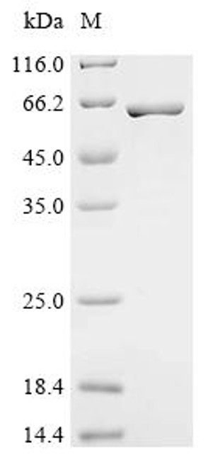 Recombinant Mycobacterium tuberculosis Uncharacterized protein Rv0647c (CSB-EP308750MVZ) Recombinant Mycobacterium tuberculosis Uncharacterized protein Rv0647c (CSB-EP308750MVZ)