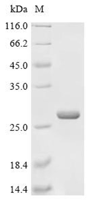 Recombinant Human Dehydrogenase/reductase SDR family member 4-like 2 (DHRS4L2) (CSB-EP747499HU) Recombinant Human Dehydrogenase/reductase SDR family member 4-like 2 (DHRS4L2) (CSB-EP747499HU)