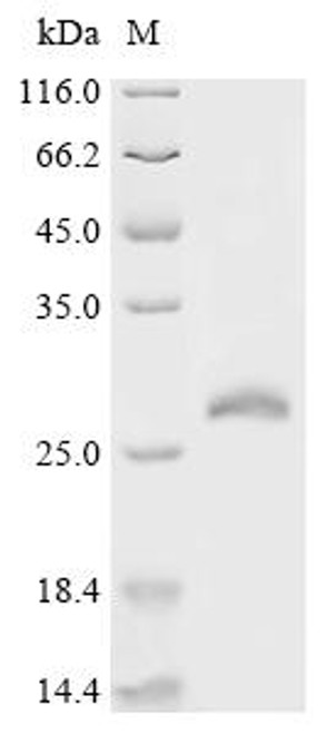 Recombinant Human Ras-related protein Rab-15 (RAB15) (CSB-EP019163HU) Recombinant Human Ras-related protein Rab-15 (RAB15) (CSB-EP019163HU)