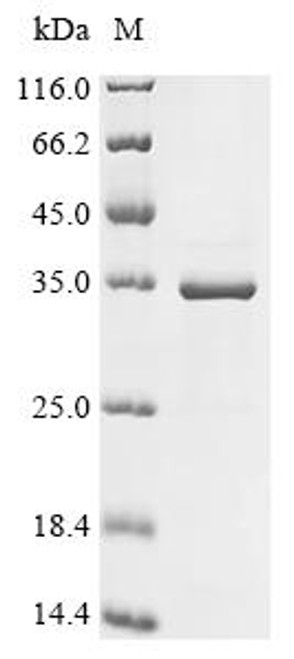 Recombinant Human SUN domain-containing protein 3 (SUN3), partial (CSB-EP848390HU1) Recombinant Human SUN domain-containing protein 3 (SUN3), partial (CSB-EP848390HU1)
