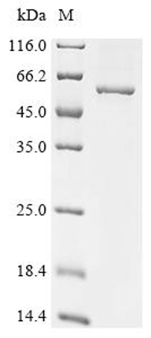 Recombinant Human T-complex protein 11-like X-linked protein 2 (TCP11X2) (CSB-EP5974HU)
