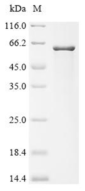 Recombinant Verticillium dahliae Pigment biosynthesis protein Ayg1 (CSB-EP6008GYB) Recombinant Verticillium dahliae Pigment biosynthesis protein Ayg1 (CSB-EP6008GYB)