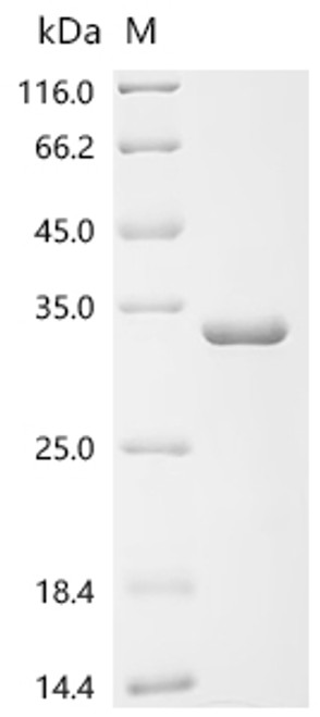 Recombinant Human Probable global transcription activator SNF2L2 (SMARCA2), partial (CSB-EP021799HU1) Recombinant Human Probable global transcription activator SNF2L2 (SMARCA2), partial (CSB-EP021799HU1)