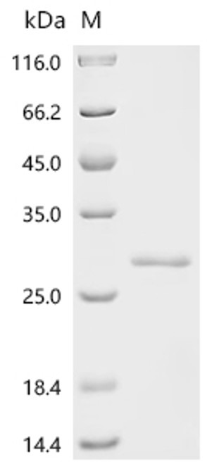 Recombinant Mycobacterium tuberculosis variant africanum PE family protein PE13 (CSB-EP5916GXIa2) Recombinant Mycobacterium tuberculosis variant africanum PE family protein PE13 (CSB-EP5916GXIa2)
