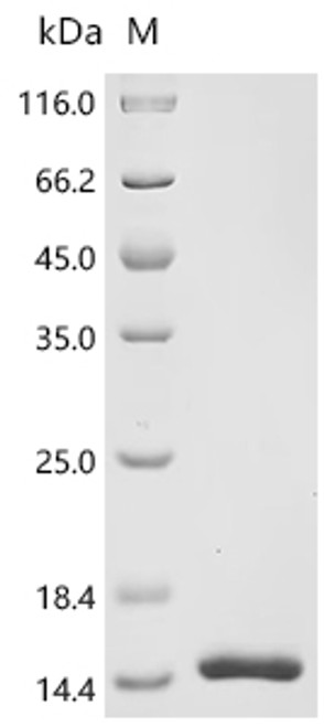 Recombinant Anguilla japonica Ventricular natriuretic peptide (vnp) (CSB-EP329334BZH) Recombinant Anguilla japonica Ventricular natriuretic peptide (vnp) (CSB-EP329334BZH)