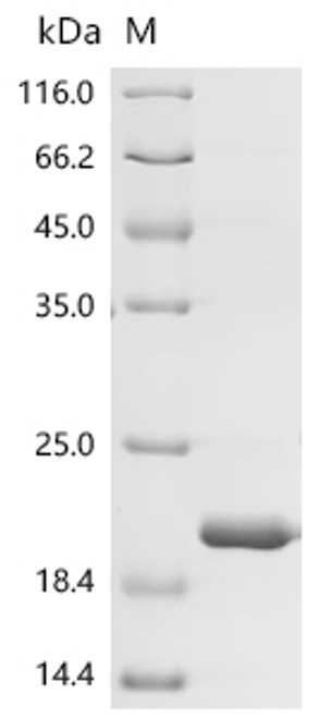 Recombinant Macaca fascicularis Kidney associated antigen 1 (CSB-EP5807MOV) Recombinant Macaca fascicularis Kidney associated antigen 1 (CSB-EP5807MOV)