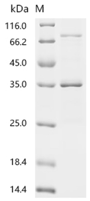 Recombinant Saponaria officinalis Ribosome-inactivating protein saporin-9 (SAP9) (L8A) (CSB-EP748739SCG(M)) Recombinant Saponaria officinalis Ribosome-inactivating protein saporin-9 (SAP9) (L8A) (CSB-EP748739SCG(M))