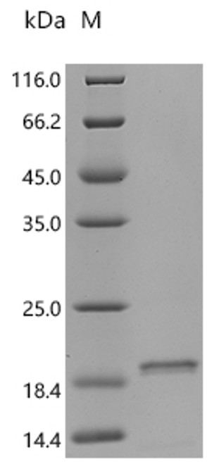 Recombinant Sheep Fibroblast growth factor 2 (FGF2) (CSB-EP008625SHc7) Recombinant Sheep Fibroblast growth factor 2 (FGF2) (CSB-EP008625SHc7)