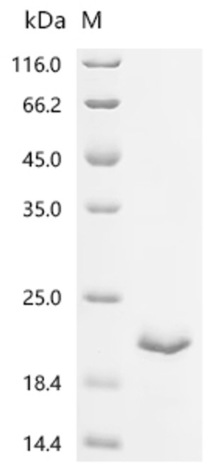 Recombinant Porcine reproductive and respiratory syndrome virus GP5, partial (CSB-EP5752GMWa2)