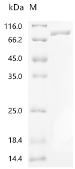 Recombinant Human Propionyl-CoA carboxylase alpha chain, mitochondrial (PCCA) (CSB-EP017522HU)