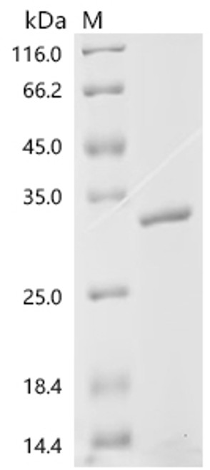 Recombinant Human Stathmin-2 (STMN2) (CSB-EP853100HU)