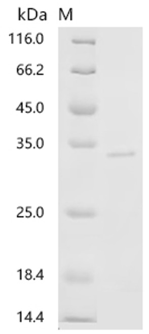 Recombinant Pig Tenascin (TNC), partial (CSB-EP642747PI)