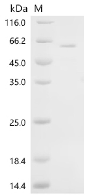 Recombinant Mouse Neurogenic differentiation factor 1 (Neurod1) (M114A) (CSB-EP720182MO(M1))