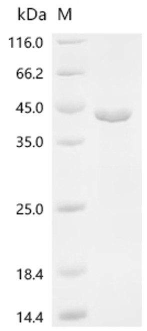Recombinant Macaca fascicularis Renin (REN) (CSB-EP715703MOV)
