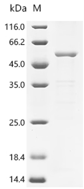 Recombinant Newcastle disease virus Fusion glycoprotein F0 (F), partial (CSB-EP330269NCU)