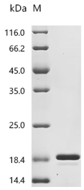 Recombinant Bovine Fibroblast growth factor 2 (FGF2) (CSB-EP008625BOe1)