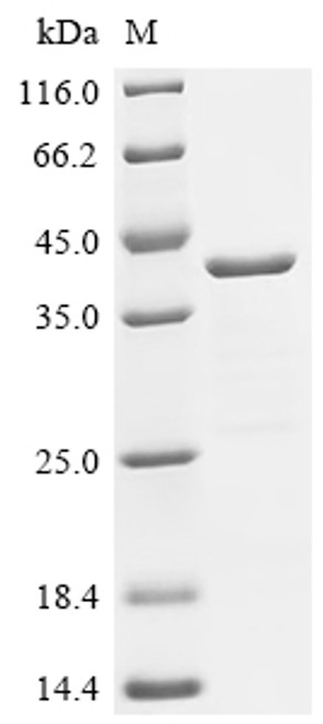 Recombinant Human cDNA FLJ11751 fis, clone HEMBA1005576, moderately similar to Mus musculus plexin 2 (H11Y,S17F) (CSB-EP5988HU(M))