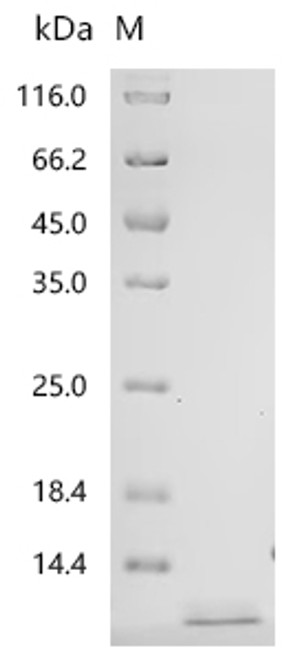 Recombinant Human Pro-epidermal growth factor (EGF), partial (CSB-EP007473HUe1)