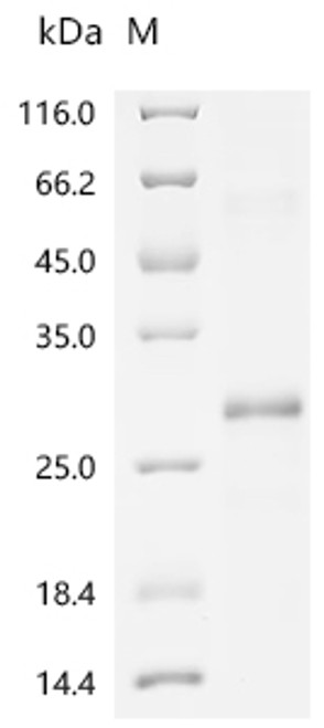 Recombinant Human Tumor necrosis factor receptor superfamily member 3 (LTBR), partial (CSB-EP013227HU1a0)