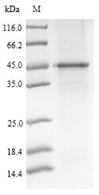 Recombinant Mouse Pyruvate dehydrogenase E1 component subunit alpha, somatic form, mitochondrial (Pdha1) (CSB-EP017715MO)