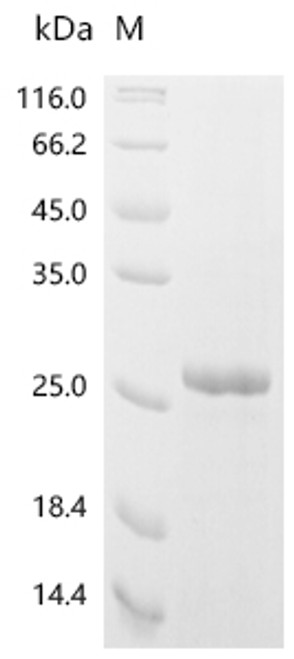 Recombinant Mouse C-C chemokine receptor type 5 (Ccr5), partial (CSB-EP004844MO)