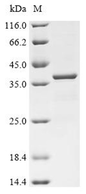Recombinant Human Alpha-tocopherol transfer protein (TTPA) (CSB-EP025268HUc7)