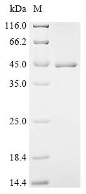 Recombinant Human F-box/LRR-repeat protein 2 (FBXL2) (CSB-EP892134HUc7)