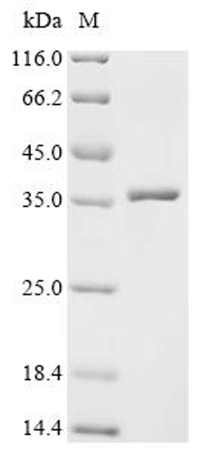 Recombinant Bombyx mori nuclear polyhedrosis virus Polyhedrin (PH) (CSB-EP355989BTU)