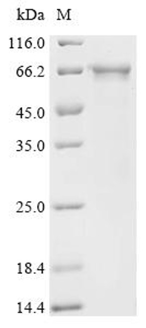Recombinant Human NACHT, LRR and PYD domains-containing protein 3 (NLRP3), partial (CSB-EP822275HU7)