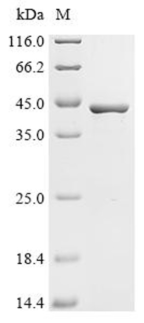 Recombinant Spirometra erinaceieuropaei Cysteine proteinase (CSB-EP5965GXS)
