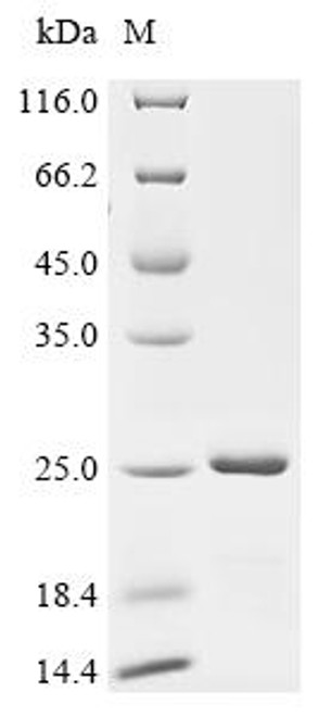 Recombinant Human Alpha-synuclein (SNCA) (CSB-EP021912HU)