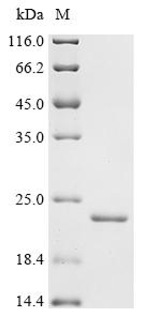 Recombinant Human Bromodomain adjacent to zinc finger domain protein 2B (BAZ2B), partial (CSB-EP883427HU)