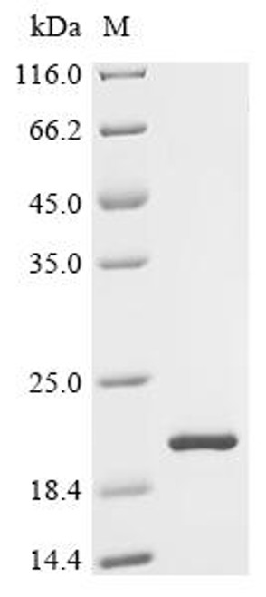 Recombinant Rat Forkhead box protein D3 (Foxd3) (CSB-EP737178RA)