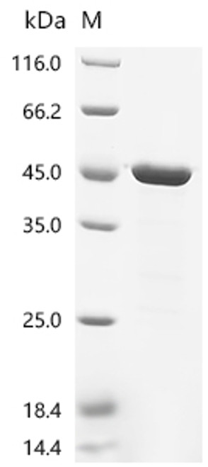 Recombinant Measles virus Nucleoprotein (N), partial (CSB-EP361386MCQa0)