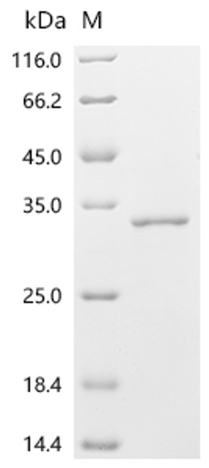 Recombinant Human ADP-ribosylation factor-like protein 4D (ARL4D) (CSB-EP002087HU)