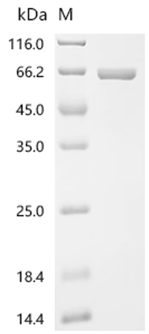 Recombinant Ustilaginoidea virens Phosphoacetylglucosamine mutase (CSB-EP6009GVZ)