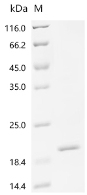 Recombinant Human Uncharacterized protein C1orf54 (C1orf54) (CSB-EP840992HUc7)