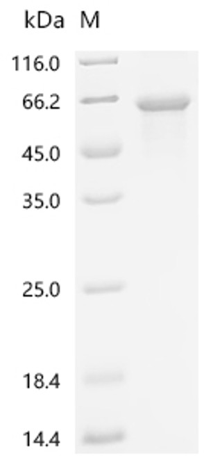 Recombinant Human E3 ubiquitin-protein ligase TRIM11 (TRIM11) (CSB-EP856931HU(A4))
