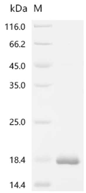 Recombinant Human C-C motif chemokine 5 (CCL5) (CSB-EP004800HUc7)