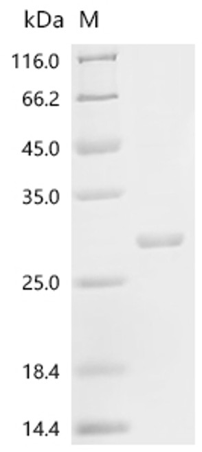 Recombinant Ricinus communis Ricin, partial (CSB-EP365798RMMe1)