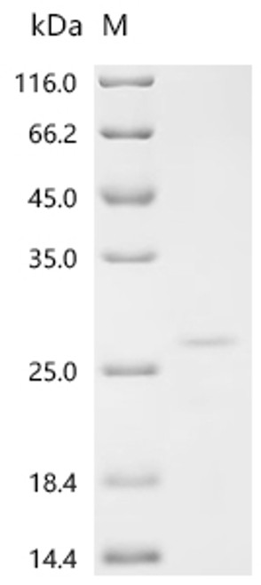 Recombinant Klebsiella pneumoniae Microcin E492 (mceA) (CSB-EP912107KBG)