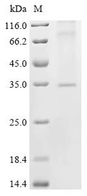 Recombinant Human Voltage-dependent calcium channel gamma-3 subunit (CACNG3) (CSB-CF004417HU)