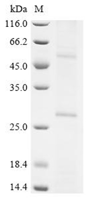 Recombinant Human Putative palmitoyltransferase ZDHHC22 (ZDHHC22) (CSB-CF822734HU)