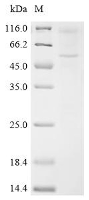 Recombinant Mouse 5-hydroxytryptamine receptor 2C (Htr2c) (CSB-CF010889MO)