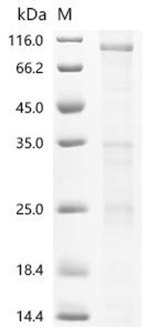 Recombinant Mouse Transient receptor potential cation channel subfamily V member 6 (Trpv6) (CSB-CF852782MO)