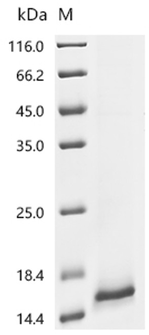 Recombinant Human Uroplakin-2 (UPK2) (CSB-CF025656HUb0)