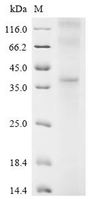 Recombinant Human Gastrin-releasing peptide receptor (GRPR) (CSB-CF009943HU(A4))